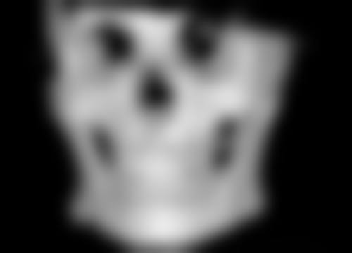 瘦脸针有副作用吗会反弹吗？专家揭秘瘦脸针效果持续性及潜在不良反应 