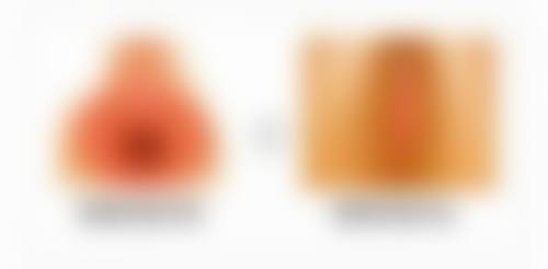 二、用什么方法去中老年眼袋之医美解决方案