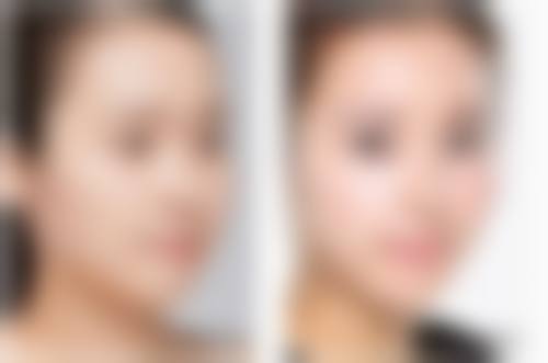 七、济宁邹城人民医院整形美容科预约方式