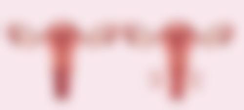 一、做完眼袋多久可以做双眼皮:间隔时间