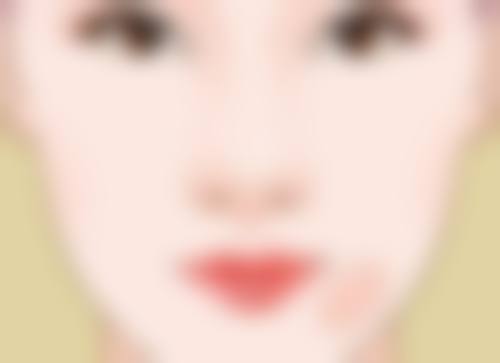 一、割双眼皮五天肿胀的正常原因