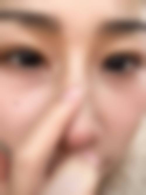 四、合肥兰积整形医院特色项目