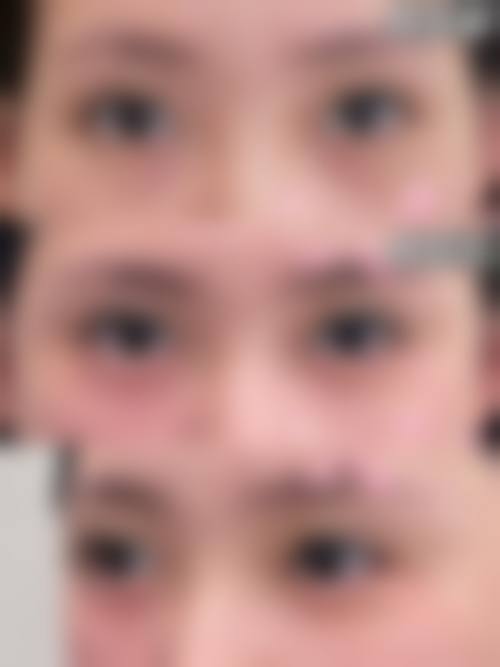 九、日本自由之丘整形美容医院真实的患者评价