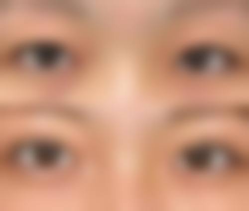 六、日本自由之丘整形美容医院价格表