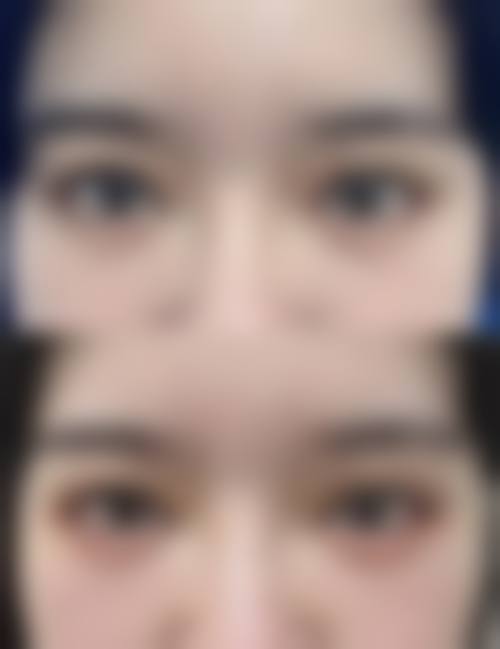 四、日本自由之丘整形美容医院特色项目