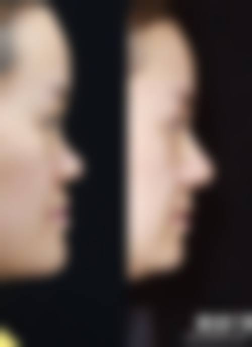 四、大连沙河口许英医疗美容诊所特色项目