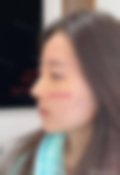 四、武汉保加整形医院特色项目