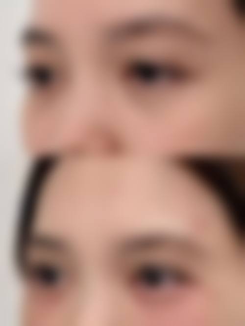 八、郑州素白整形医院真实的患者评价