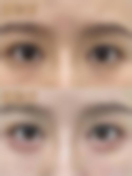 四、郑州素白整形医院特色项目