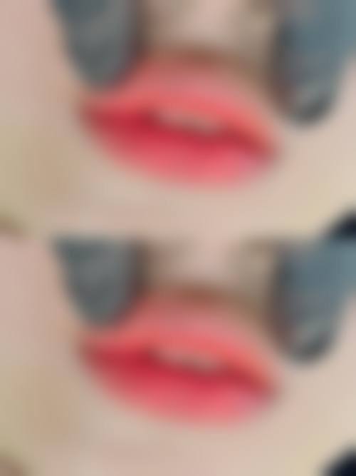 二、韩国YNT整形外科医院怎么样?