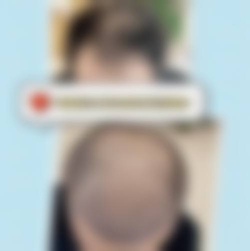 四、温州玉尚美医疗美容南白象整形外科门诊部特色项目