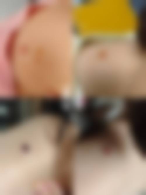 二、济宁邹城人民医院整形美容科怎么样?