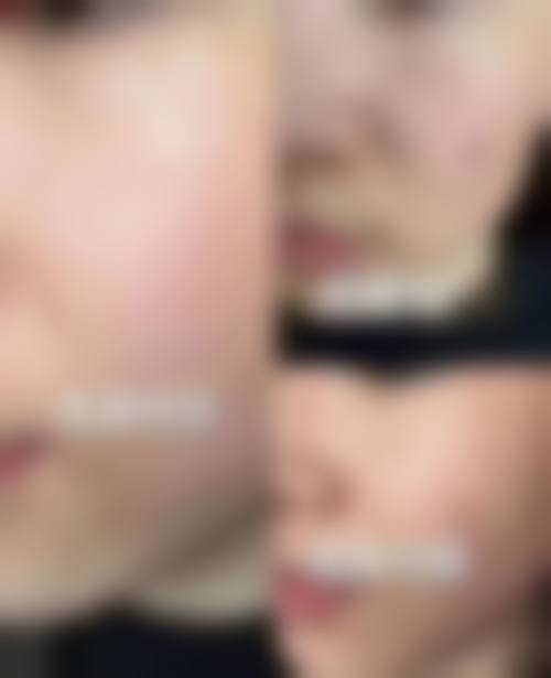 五、武汉星美汇整形医院价格表