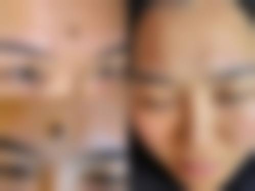 四、深圳睿美医疗美容诊所特色项目