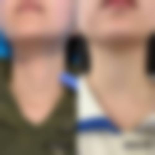 二、西安泓芝整形医院怎么样?