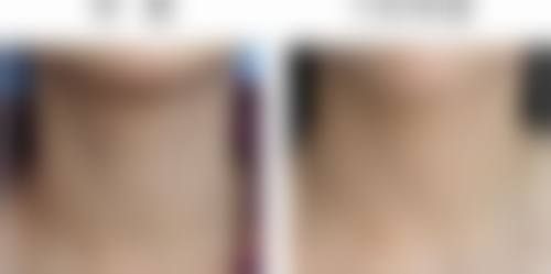 三、宿州美莱整形医院诊疗项目有哪些?