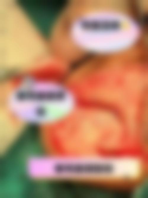 四、德宏富华医学整形美容门诊部特色项目