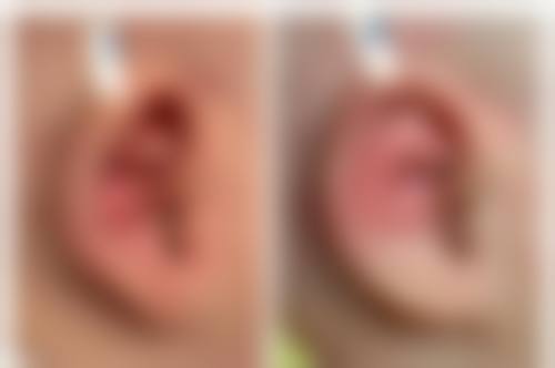 五、德宏富华医学整形美容门诊部价格表