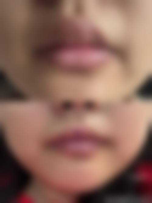 三、郑州大同医疗美容诊所诊疗项目有哪些?