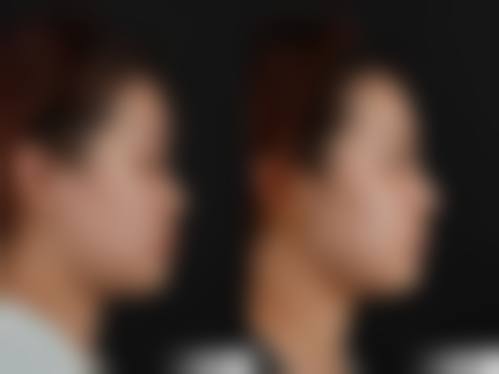 三、Sheron技术优势