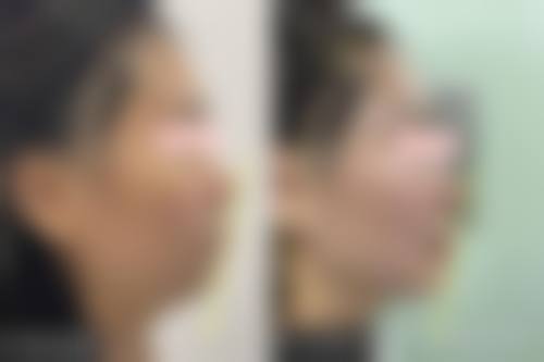 四、天津艾斯美尔医疗美容诊所特色项目