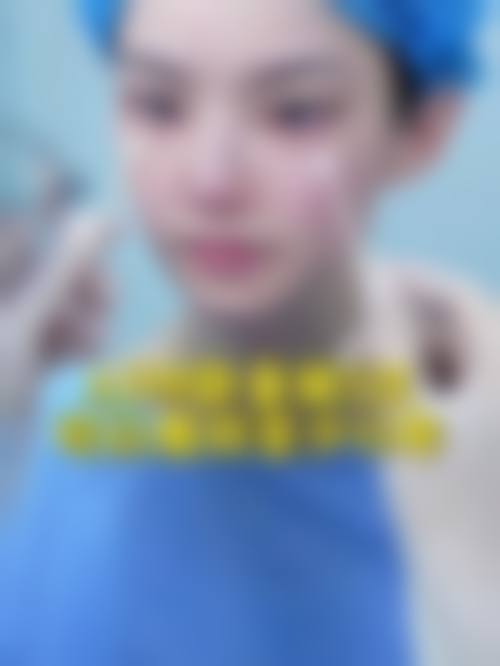 八、西安泓芝整形医院预约方式