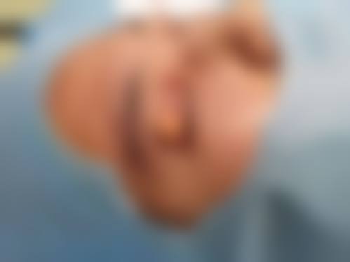 三、济宁邹城人民医院整形美容科诊疗项目有哪些?