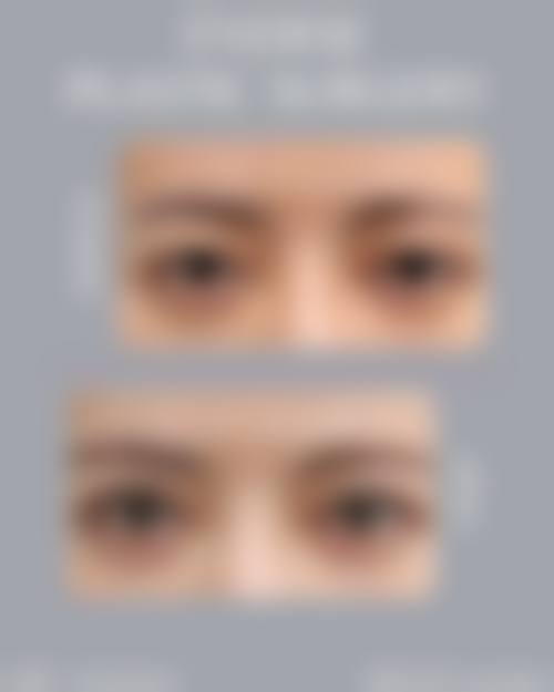 六、天津艾斯美尔医疗美容诊所价格表