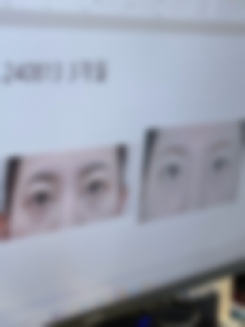 四、济宁邹城人民医院整形美容科特色项目