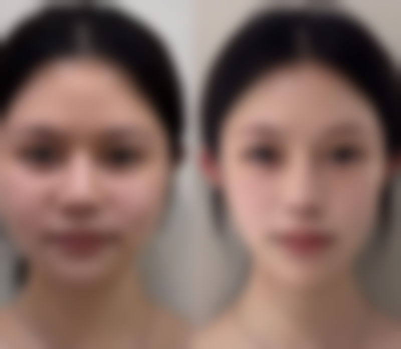 八、邢台致美奈医疗美容诊所真实的患者评价