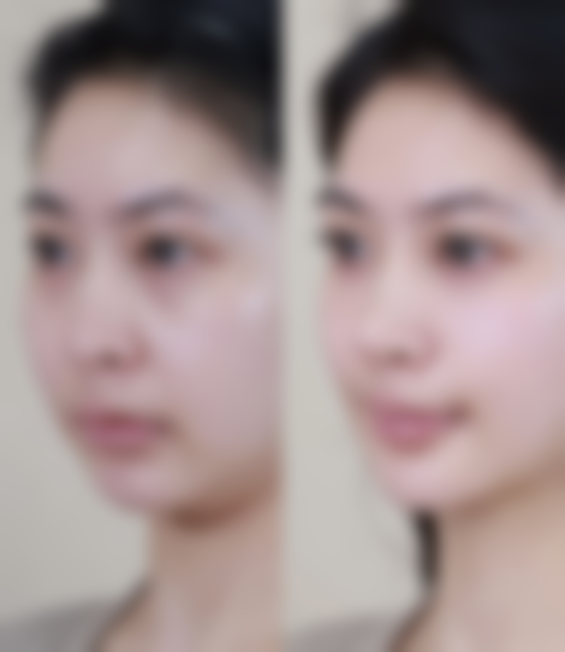 四、南京美好尉来医疗美容门诊部特色项目