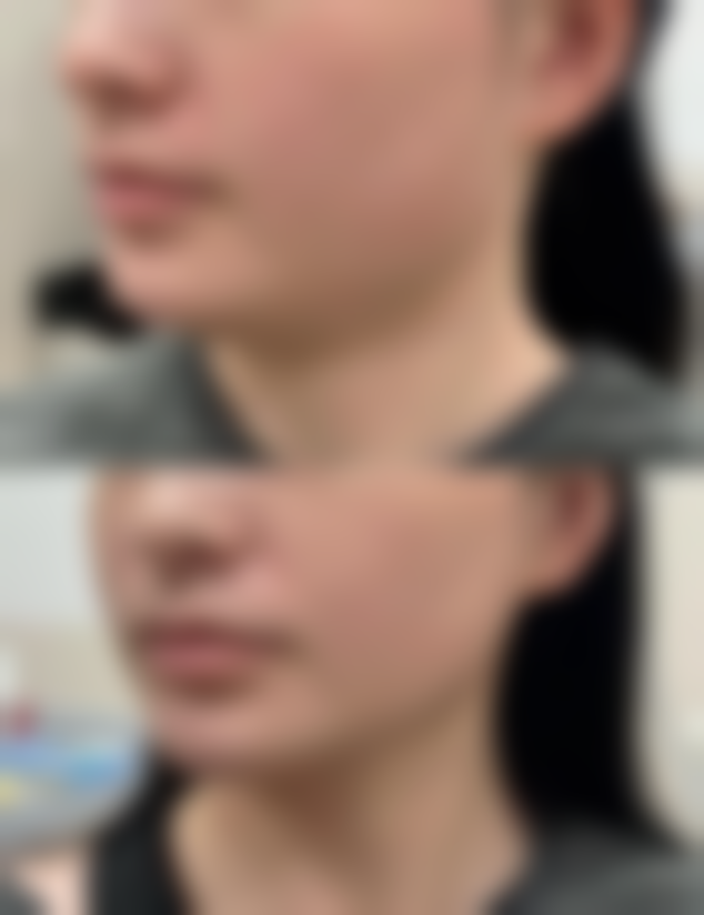 三、韩国YNT整形外科医院诊疗项目有哪些?