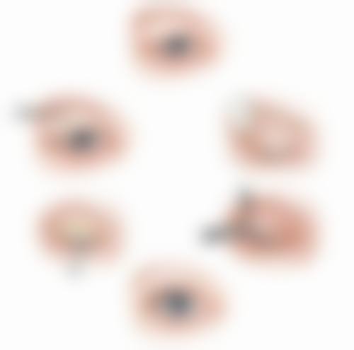 一、增生疤痕擦疤克的成效分析