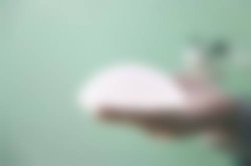 割双眼皮一般多长时间能恢复正常？手术方式、体质等多因素影响恢复周期