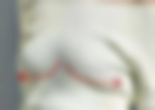 二、艾灸眼部能消眼袋吗?探究艾灸的作用与局限