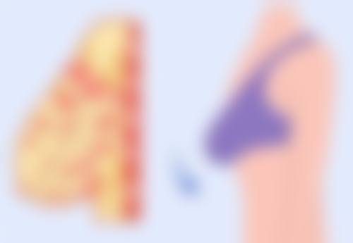 疤痕能自己恢复吗？了解不同类型疤痕恢复情况及有效治疗方法 