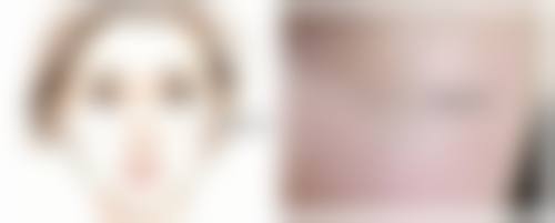 一、艾灸眼部能消眼袋吗?深入剖析眼袋成因