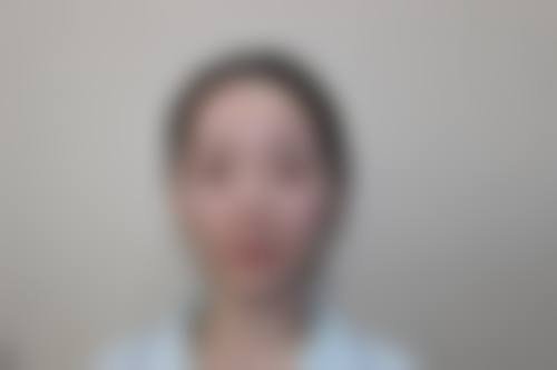 九、北京荣军 医院激光美容中 心真实的患者评价