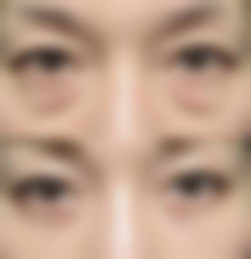 八、北京荣军 医院激光美容中 心预约方式