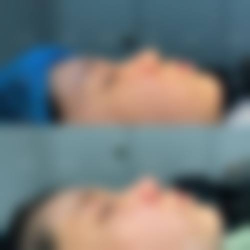 七、芜湖市第一人民医院(皮肤美容科)预约方式