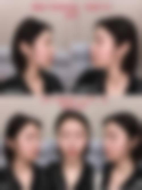 九、龙岩欧菲整形医疗美容门诊部真实的患者评价