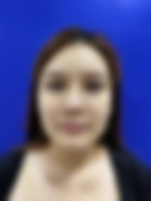 四、成都幽兰美医疗美容诊所特色项目