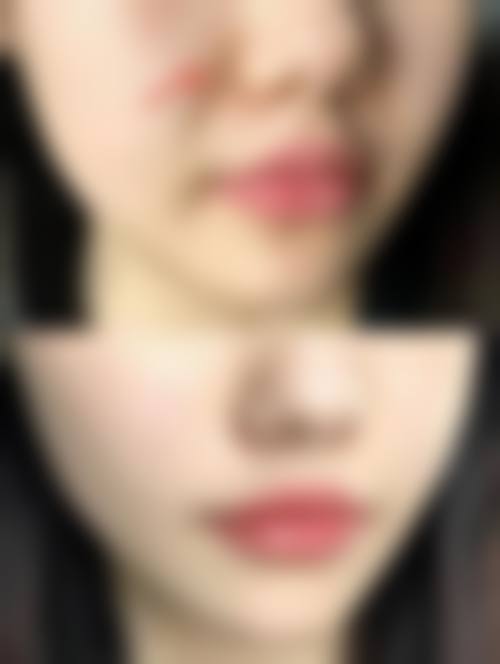 二、湖南长沙初生整形医院怎么样?