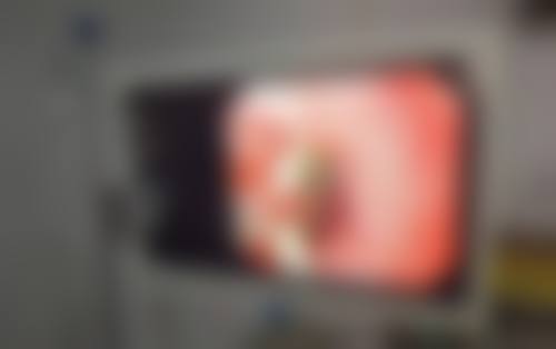 八、成都幽兰美医疗美容诊所真实的患者评价