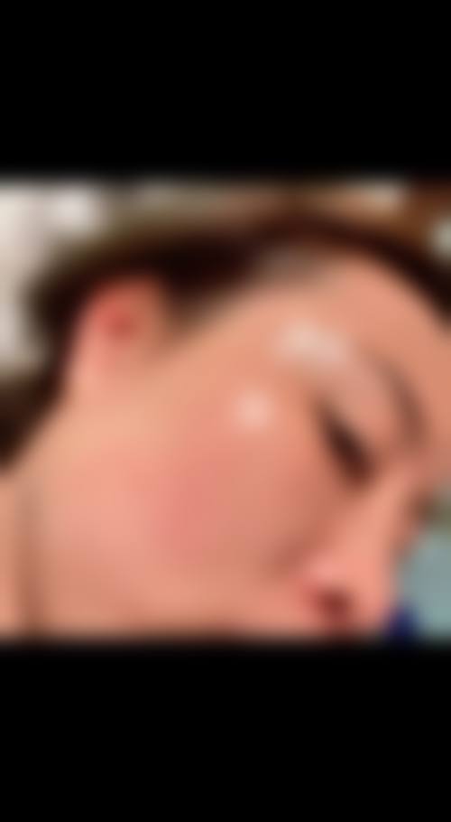 四、北京荣军 医院激光美容中 心特色项目