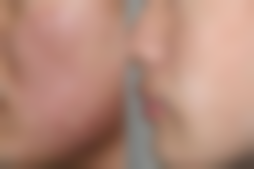 六、北京泛美医疗美容价格表