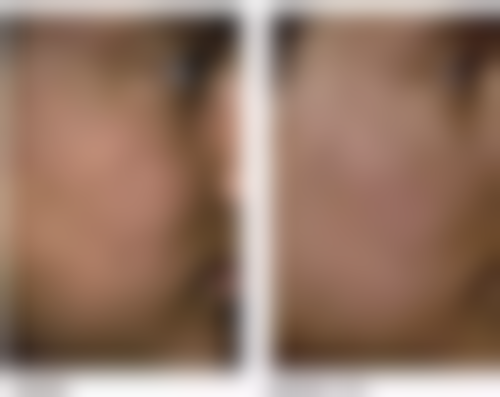 四、青岛福田医疗美容医院特色项目