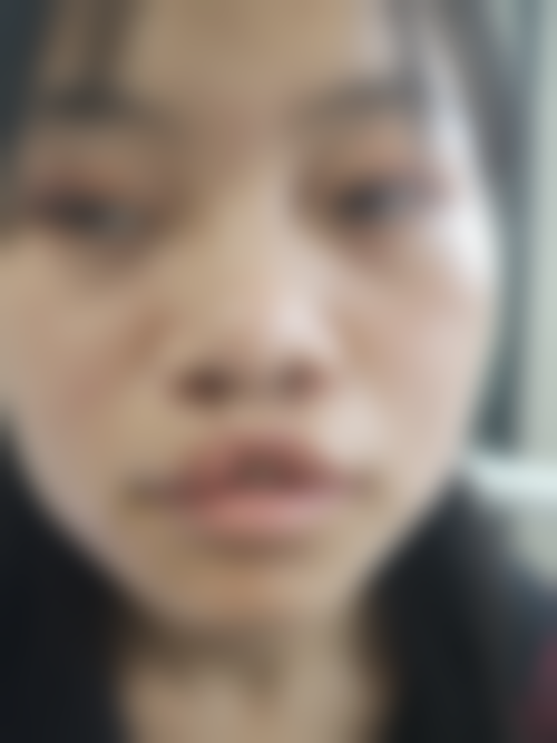 五、苏州张家港卓妍整形医院价格表