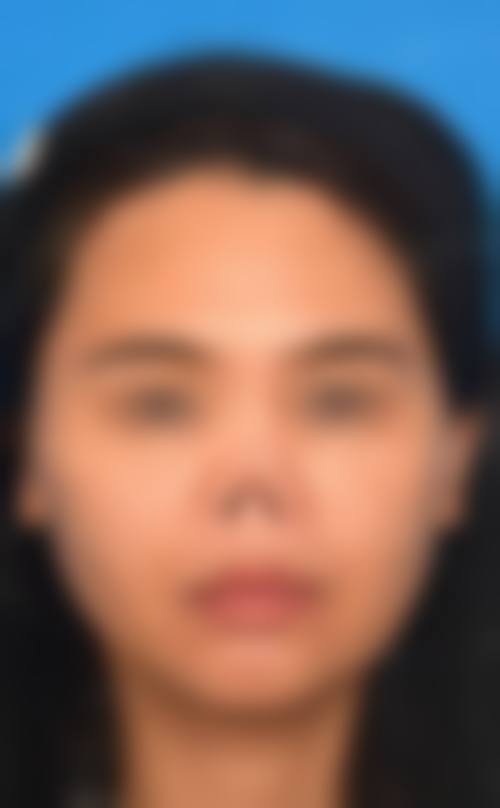 八、重庆夫碧韦弗整形医院真实的患者评价