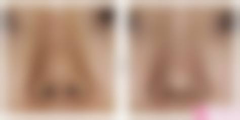 四、芜湖市第一人民医院(皮肤美容科)特色项目